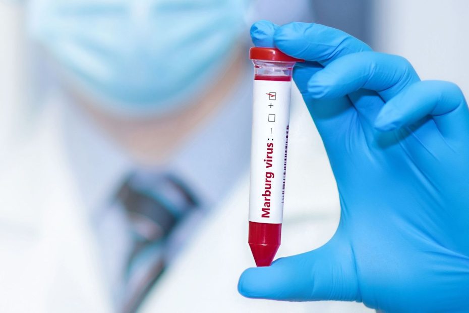  Virus de Marburg : L’Oms se prépare à la riposte