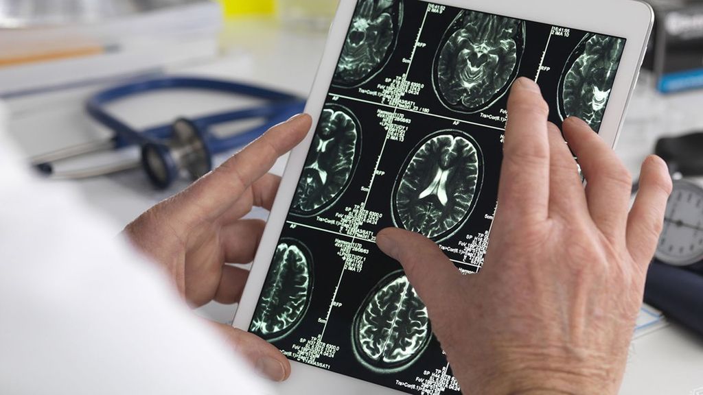 Troubles neurologiques: Principale cause mondiale de maladies et d’invalidité
