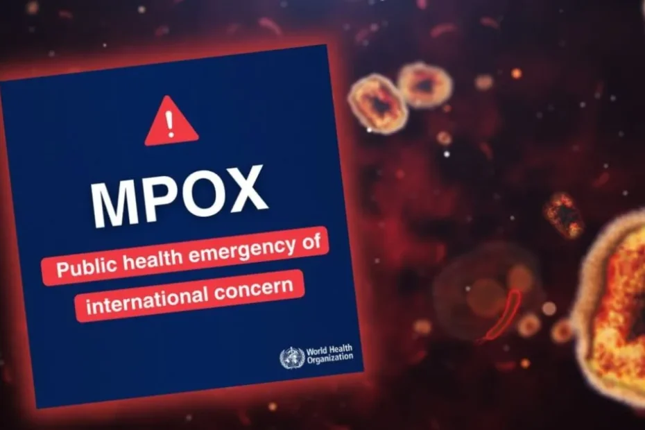 Variole du singe: Une urgence de santé publique de portée internationale (USPI) selon l'OMS