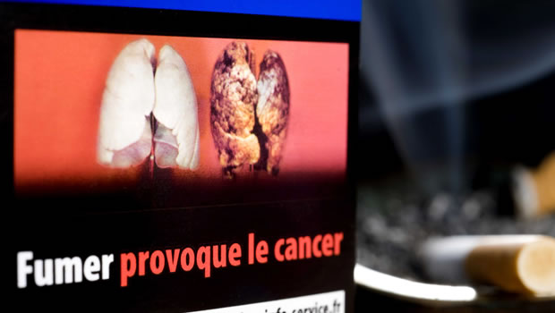 Un projet de décret pour apposer des images choc sur les paquets de cigarettes