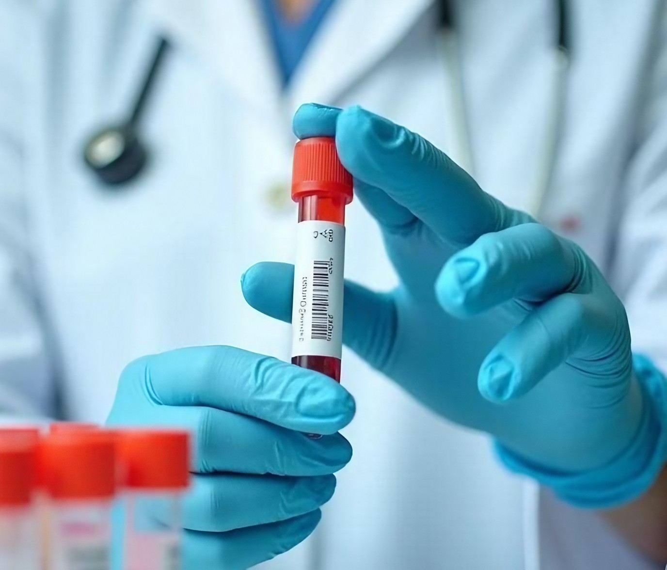 Les infections aux hépatites virales B et C en hausse, le Sud le plus touché