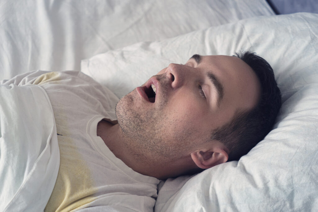 Apnée du sommeil : 40% des patients souffrent de maladies cardio métaboliques