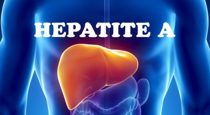 Hépatite A : le nombre de cas a été multiplié par cinq entre 2022 et 2023, selon l’INSP