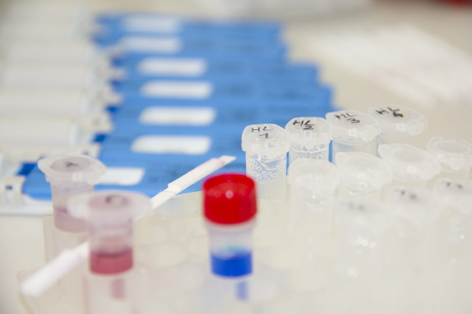Test de dépistage de drogues : Les biologistes réclament un cadre réglementaire clair