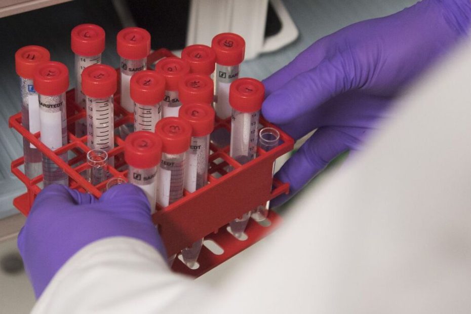 Elimination du cancer du col de l’utérus : Un objectif réaliste et atteignable, selon l’OMS