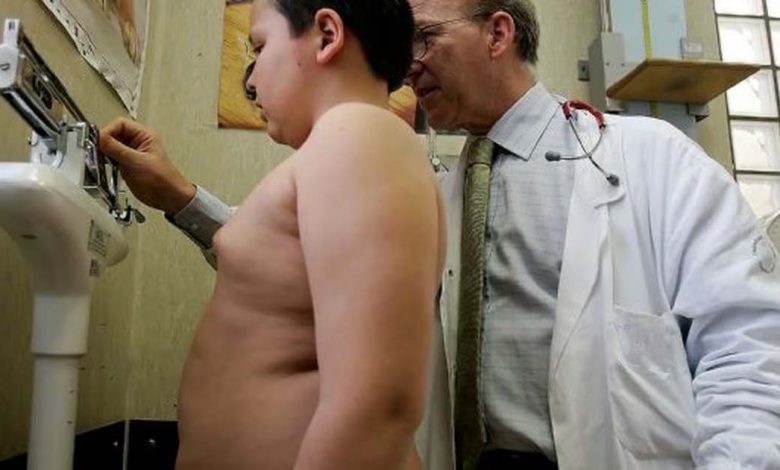 Obésité en Algérie : Une épidémie silencieuse qui appelle à une action urgente