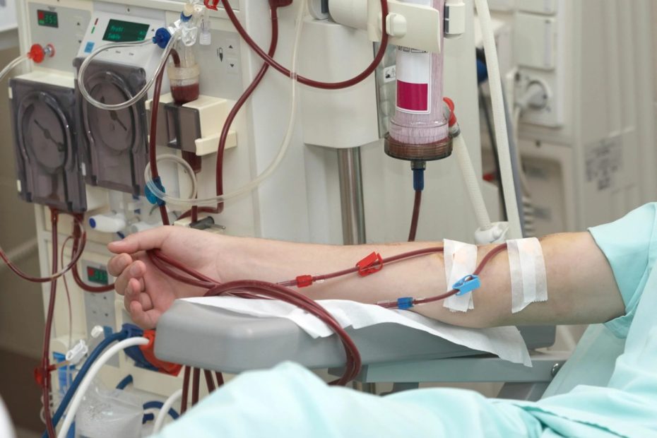 Appel a l'introduction de la dialyse à haute perméabilité dans les centres privés